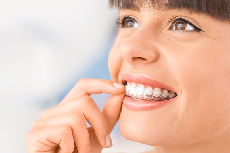 Invisalign in Corte Madera