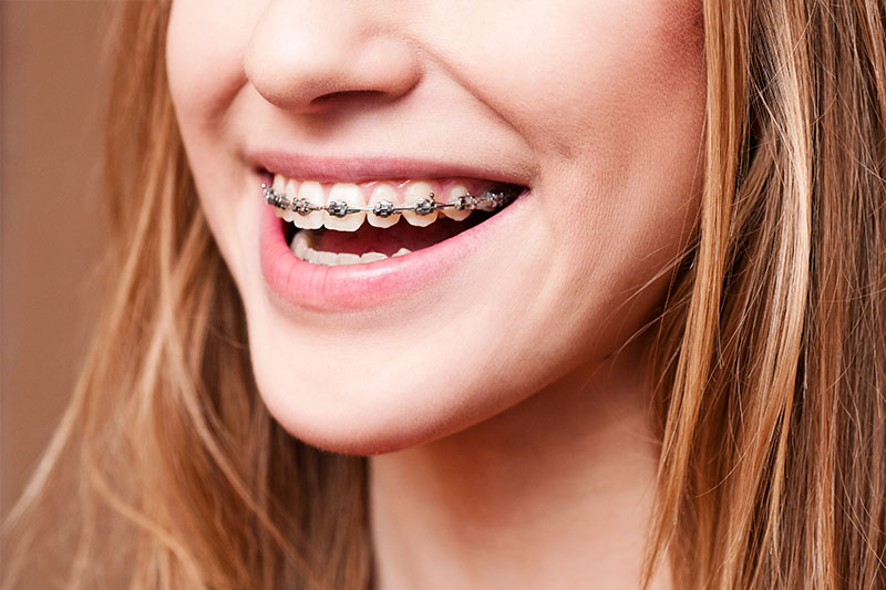 Orthodontics in Corte Madera